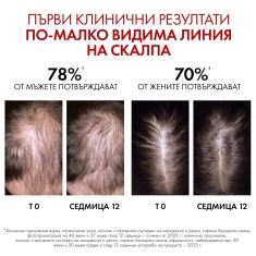 Vichy Dercos Aminexil Clinical R.E.G.E.N. Booster Серум за обновяване на косата 90 ml