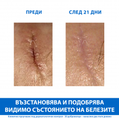 Uriage Bariederm CICA Възстановяващ изолиращ крем с Cu-Zn 40 ml