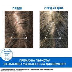 Uriage DS Hair Третиращ шампоан против пърхот 200 ml