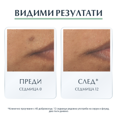 Eucerin DermoPure Серум с тройно действие 40 ml