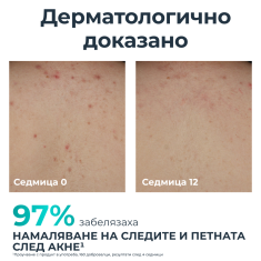 Eucerin® DERMOPURE CLINICAL Коригиращ крем за тяло 200 ml