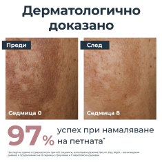 Eucerin Комплект Anti-Pigment Измиващ гел 200 ml + Дневен крем SPF30 50 ml