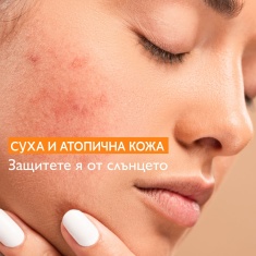 A-Derma Exomega Control SPF50+ Слънцезащитен емолиентен крем 150 ml