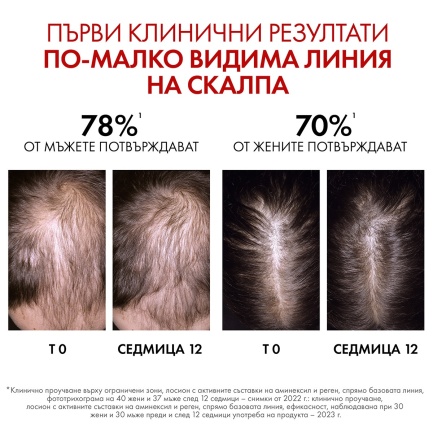 Vichy Dercos Aminexil Clinical R.E.G.E.N. Booster Серум за обновяване на косата 90 ml