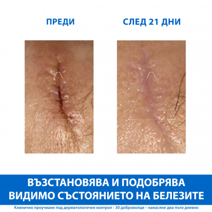 Uriage Bariederm CICA Възстановяващ изолиращ крем с Cu-Zn 40 ml